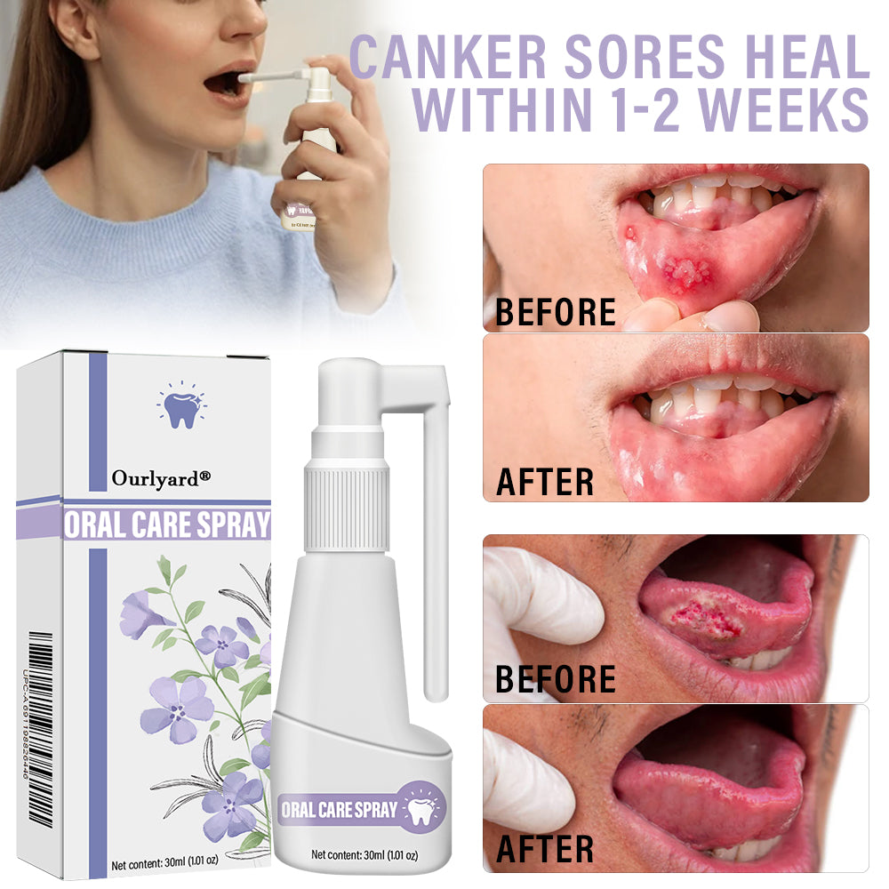 ✅Official Store | Ourlyard® Clove Oil Oral Care Spray 🧑🏼⚕️ Obtain MHRA Registration